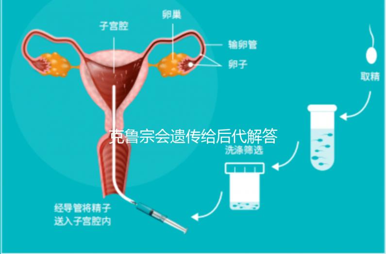 克魯宗會遺傳給后代解答嗎？他生來就有一篇清晰的文章嗎？