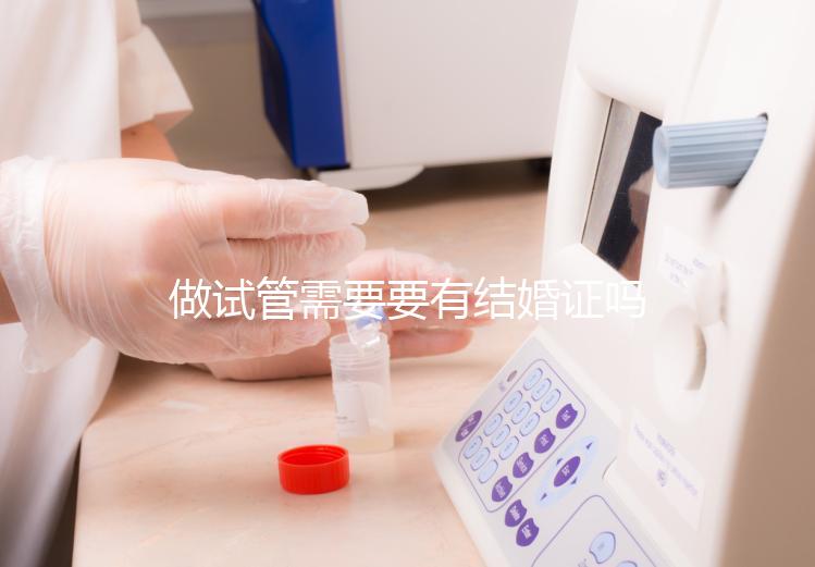 做試管需要要有結(jié)婚證嗎？