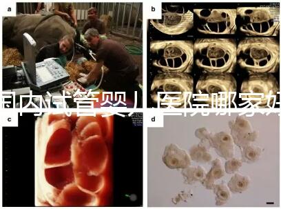 國內試管嬰兒醫院哪家好？慈銘博鰲深受患者信賴