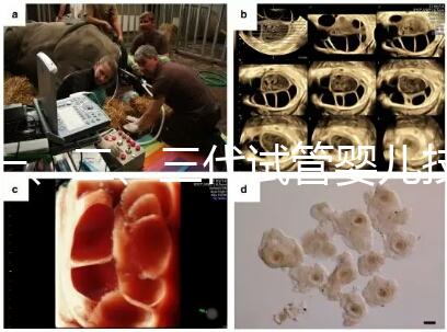 一、二、三代試管嬰兒技術(shù)的區(qū)別，看完你就知道了！