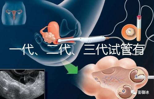 一代、二代、三代試管有什么區別？