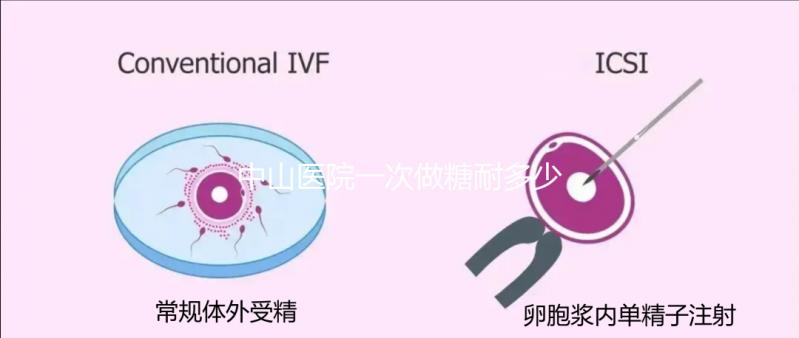 中山醫院一次做糖耐多少錢？你想預約專家嗎？