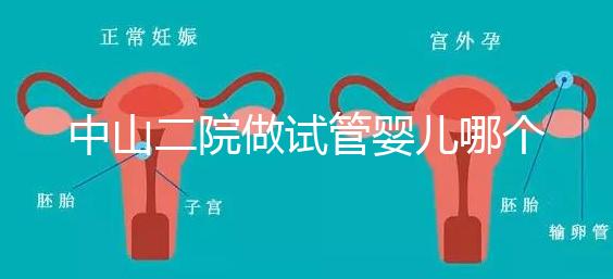 中山二院做試管嬰兒哪個醫生好？附醫院試管成功率