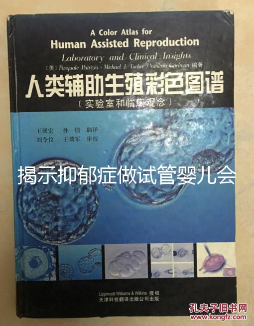 揭示抑郁癥做試管嬰兒會(huì)遺傳給女兒，想避免看這個(gè)