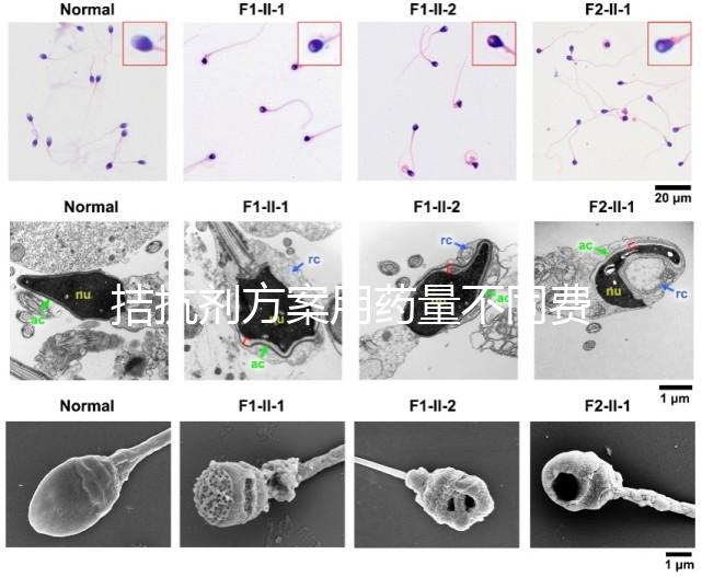 拮抗劑方案用藥量不同費用也不一樣，看看大家都花了多少