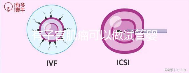 有子宮肌瘤可以做試管嬰兒嗎(有子宮肌瘤可以做試管嬰兒嗎多少錢)