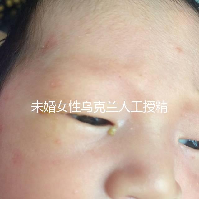 未婚女性烏克蘭人工授精必看!醫療及生活費用明細預覽