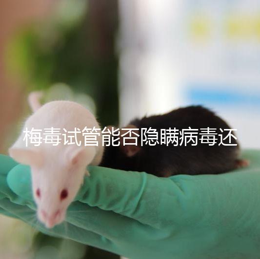 梅毒試管能否隱瞞病毒還沒有建造，備案記錄已經(jīng)通知