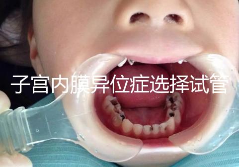 子宮內(nèi)膜異位癥選擇試管嬰兒有3大理由,成功率是其一