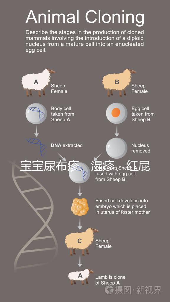 寶寶尿布疹、濕疹、紅屁股傻傻分不清？4點(diǎn)區(qū)別輕松診斷