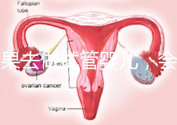 如果去做試管嬰兒，會有什么利與弊？