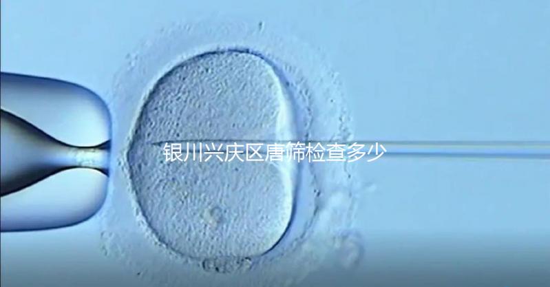 銀川興慶區(qū)唐篩檢查多少錢(qián)取決于情況,2024年國(guó)家免費(fèi)限額