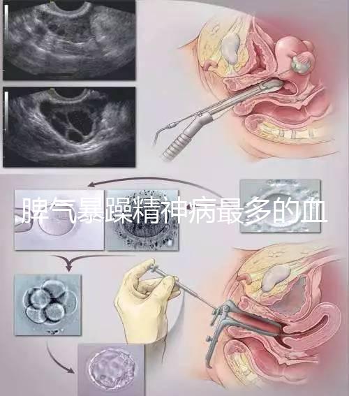 脾氣暴躁精神病最多的血型竟是…，4大血型隱藏了不同疾病