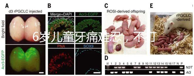 6歲兒童牙痛難忍，不打針吃藥5個小妙招快速止疼