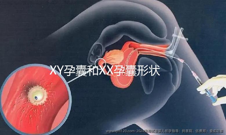 XY孕囊和XX孕囊形狀各有差異，橢圓形可能是懷女哦！