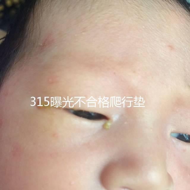 315曝光不合格爬行墊品牌，甲酰胺超標(biāo)的危害可不小