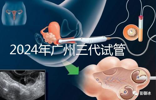 2024年廣州三代試管嬰兒費用明細公布！