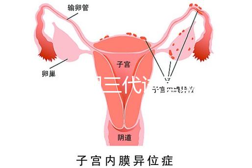 2025昆明三代試管助孕費(fèi)用一覽,8-15萬(wàn)元,價(jià)格透明公開(kāi)自主選擇
